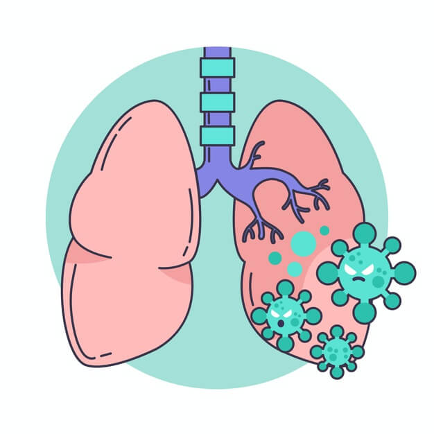 ذات الریه چیست